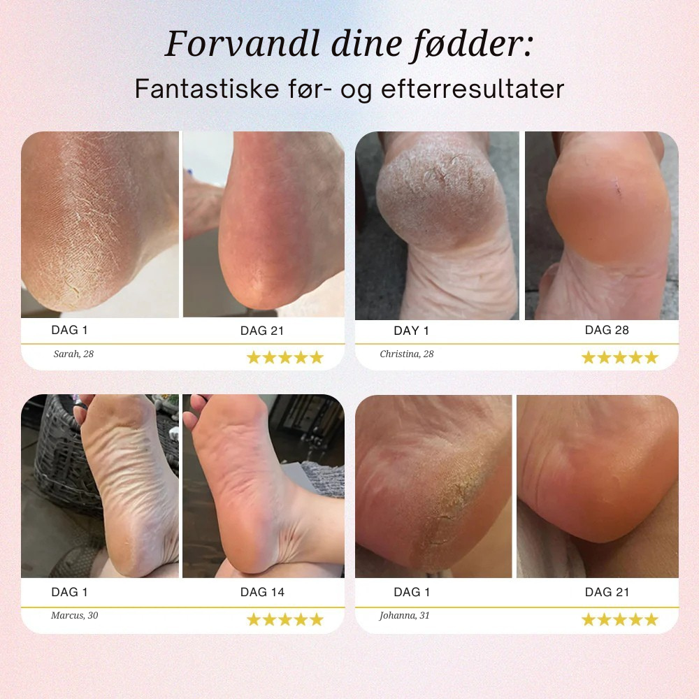 Bliss Silk Pro 2 – Bløde fødder uden dyre salonbesøg