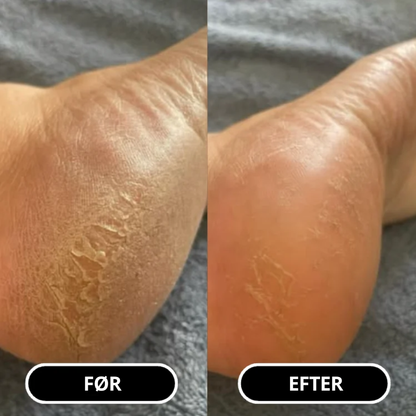 SilkFoot Relief Stick – Silkebløde fødder året rundt