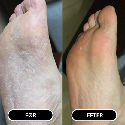 SilkFoot Relief Stick – Silkebløde fødder året rundt